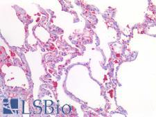 STK11 / LKB1 Antibody - Human Lung: Formalin-Fixed, Paraffin-Embedded (FFPE)