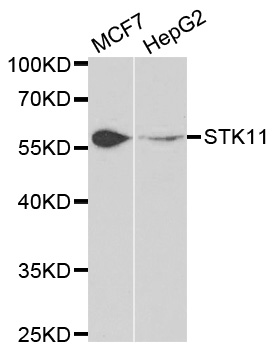 STK11 / LKB1 Antibody - Western blot analysis of extracts of various cell lines, using STK11 antibody.