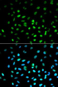 STK11 / LKB1 Antibody - Immunofluorescence analysis of MCF7 cell using STK11 antibody. Blue: DAPI for nuclear staining.
