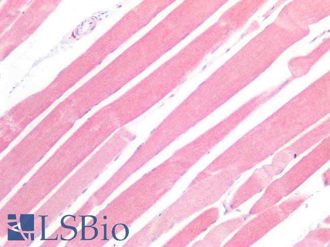 STK11 / LKB1 Antibody - Human Skeletal Muscle: Formalin-Fixed, Paraffin-Embedded (FFPE)
