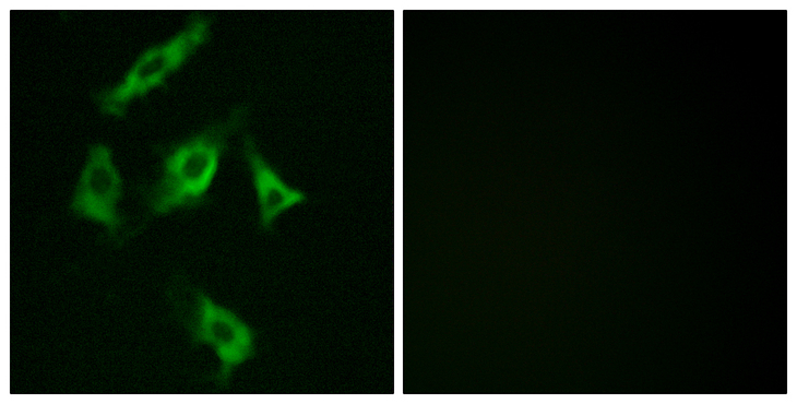 STMN1 / Stathmin / LAG Antibody - Immunofluorescence analysis of COS7 cells, using Stathmin 1 Antibody. The picture on the right is blocked with the synthesized peptide.