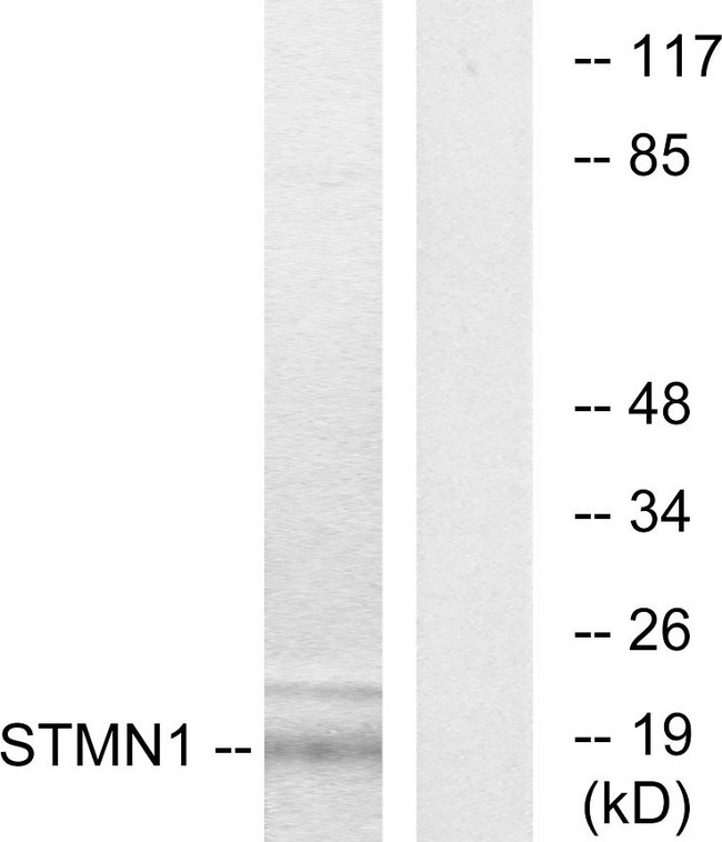 STMN1 / Stathmin / LAG Antibody - Western blot analysis of lysates from COS7 cells, using Stathmin 1 Antibody. The lane on the right is blocked with the synthesized peptide.