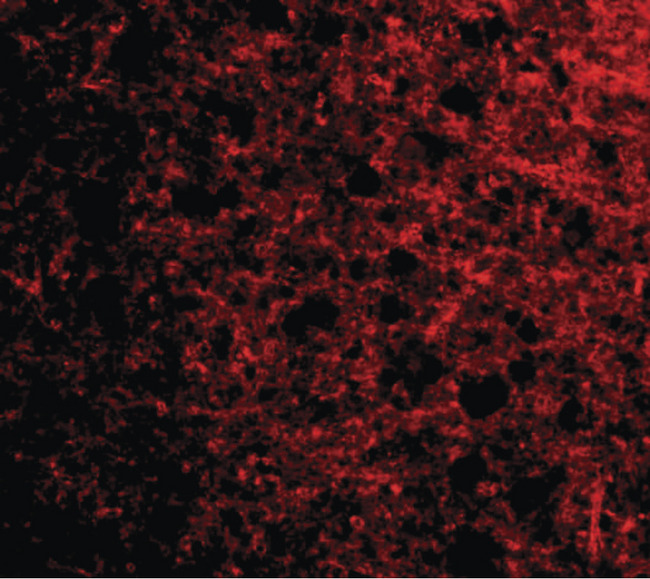 STMN1 / Stathmin / LAG Antibody - Immunofluorescence of op18 in human brain tissue with op18 antibody at 20 ug/ml.