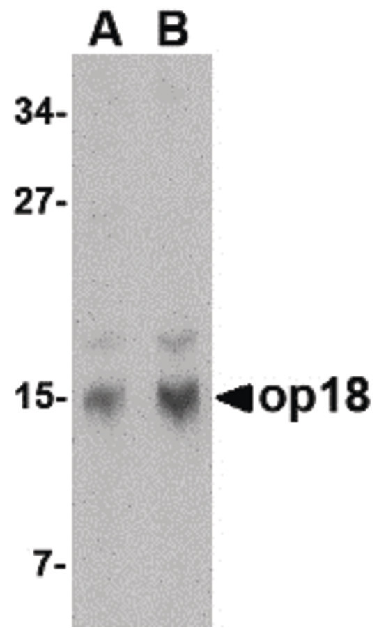 STMN1 / Stathmin / LAG Antibody - Western blot of op18 in human brain tissue lysate with op18 antibody at (A) 0.5 and (B) 1 ug/ml.