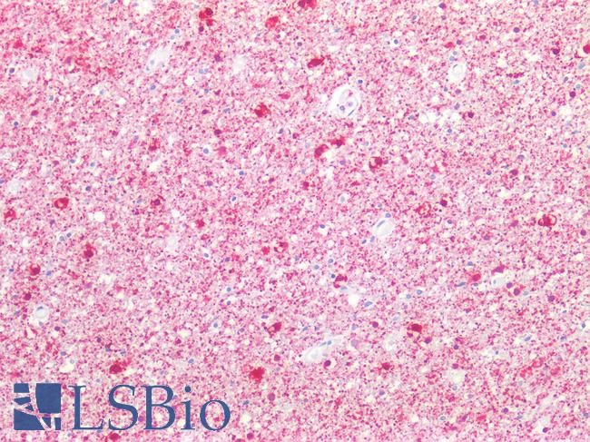 STMN1 / Stathmin / LAG Antibody - Human Brain, Cortex: Formalin-Fixed, Paraffin-Embedded (FFPE)
