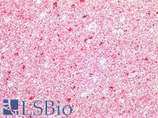 STMN1 / Stathmin / LAG Antibody - Human Brain, Cortex: Formalin-Fixed, Paraffin-Embedded (FFPE)