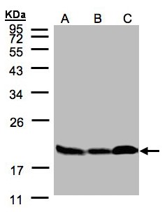 STMN1 / Stathmin / LAG Antibody - Sample(30 g of whole cell lysate). A:293T. B: A431. C: H1299. 12% SDS PAGE. STMN1 antibody diluted at 1:3000.