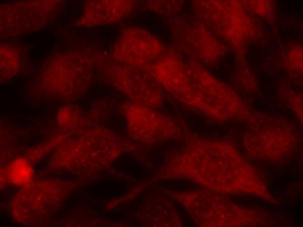 STMN1 / Stathmin / LAG Antibody - Immunofluorescence staining of methanol-fixed HeLa cells using Stathmin 1(Ab-38) antibody.