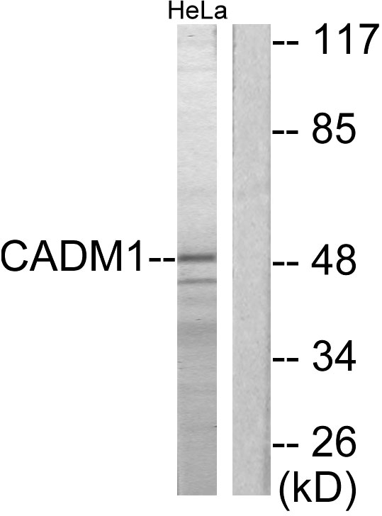 SYNCAM / CADM1 Antibody - Western blot analysis of lysates from HeLa cells, using CADM1 Antibody. The lane on the right is blocked with the synthesized peptide.