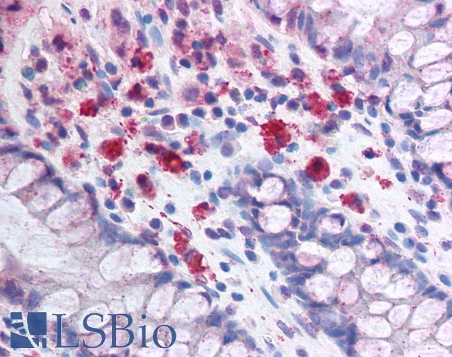 SYNCAM / CADM1 Antibody - Anti-CADM1 antibody IHC of human colon, lamina propria macrophages. Immunohistochemistry of formalin-fixed, paraffin-embedded tissue after heat-induced antigen retrieval. Antibody dilution 1:500.