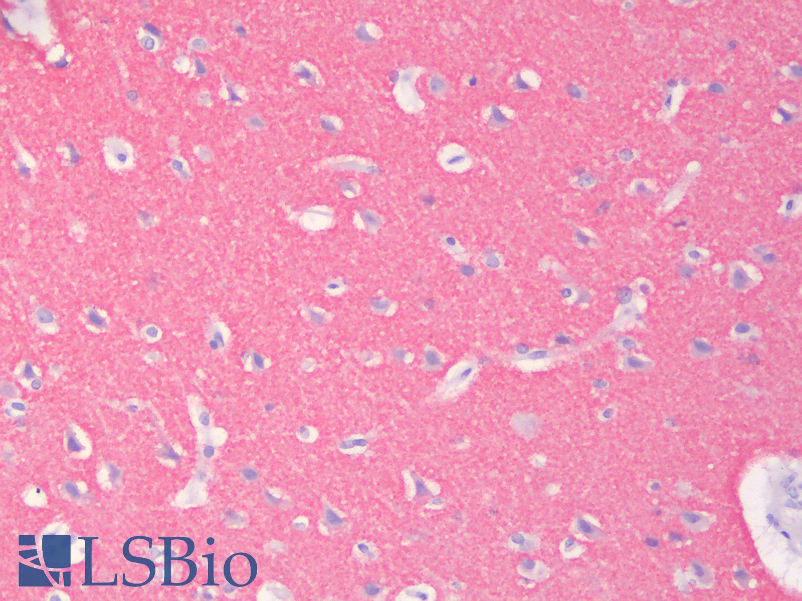 SYP / Synaptophysin Antibody - Human Brain, Cortex: Formalin-Fixed, Paraffin-Embedded (FFPE)
