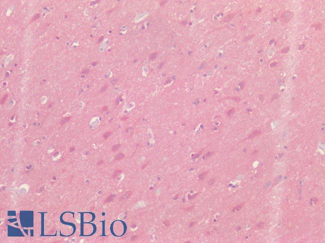T1R3 / TAS1R3 Antibody - Human Brain, Cortex: Formalin-Fixed, Paraffin-Embedded (FFPE)