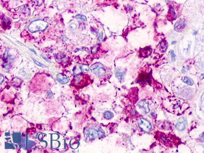 TAAR2 / GPR58 Antibody - Pancreas, carcinoma