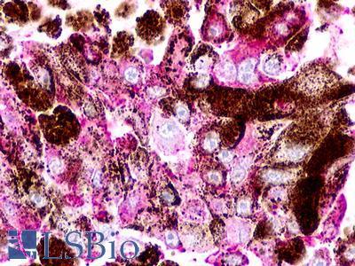 TAAR2 / GPR58 Antibody - Skin, Malignant Melanoma