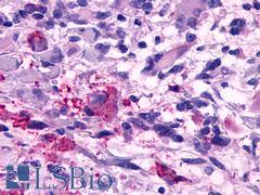 TAAR5 Antibody - Brain, Glioblastoma