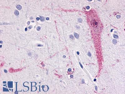 TAAR6 Antibody - Brain, Cortex, Neuron and glia