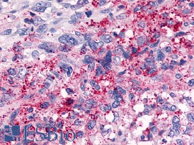 TAAR6 Antibody - Brain, Glioblastoma