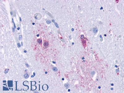 TAAR9 Antibody - Brain, Caudate, Neurons and Glia