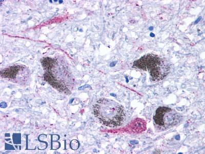 TAAR9 Antibody - Brain, Substantia Nigra, neurons