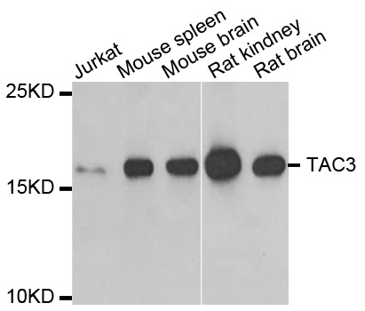 TAC3 / Tachykinin Antibody - Western blot analysis of extracts of various cell lines, using TAC3 antibody.