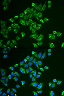 TAC3 / Tachykinin Antibody - Immunofluorescence analysis of HeLa cells.