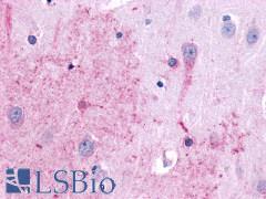 TACR3 / NK3R Antibody - brain, Hippocampus