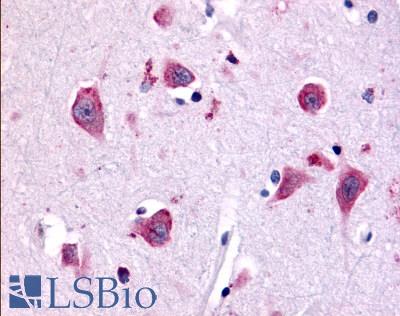 TAOK1 / TAO1 Antibody - Brain, Amygdala, neurons and glia