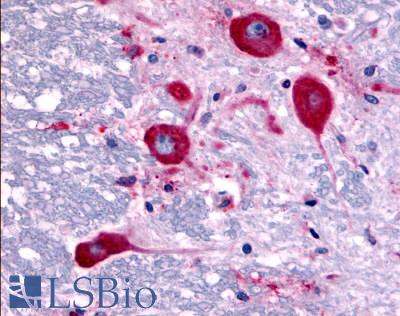 TAOK1 / TAO1 Antibody - Brain, Medulla, neurons of the lateral cuneate nucleus