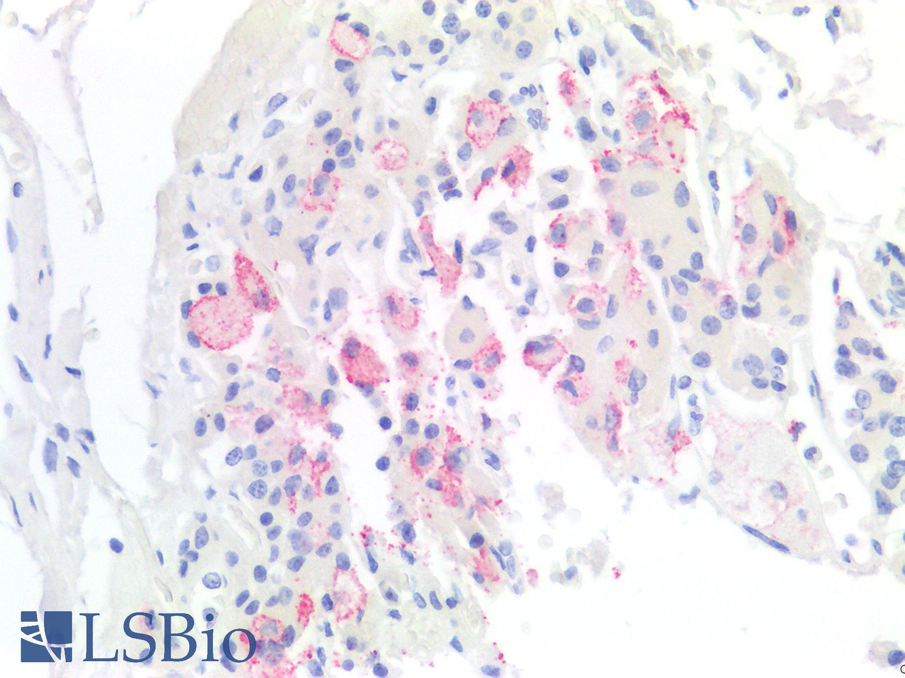 TBXT / T / Brachyury Antibody - Human Pituitary: Formalin-Fixed, Paraffin-Embedded (FFPE)