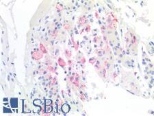 TBXT / T / Brachyury Antibody - Human Pituitary: Formalin-Fixed, Paraffin-Embedded (FFPE)