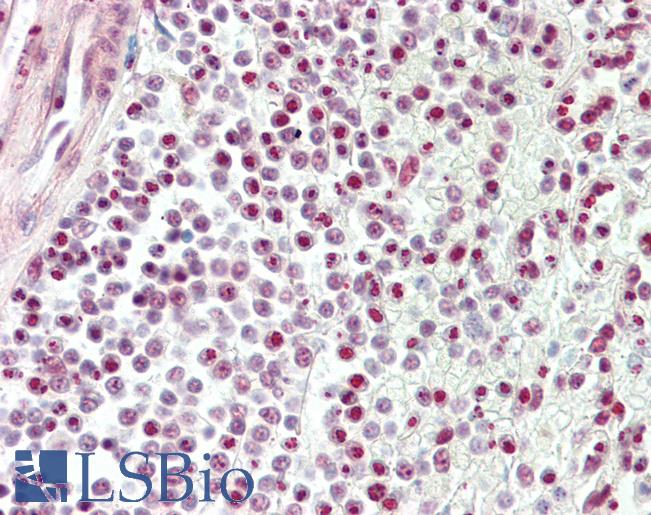 TDP-43 / TARDBP Antibody - Anti-TDP-43 / TARDBP antibody IHC staining of human spleen. Immunohistochemistry of formalin-fixed, paraffin-embedded tissue after heat-induced antigen retrieval.