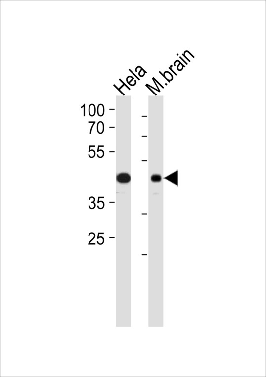 TDP-43 / TARDBP Antibody - TARDBP Antibody western blot of HeLa cell line and mouse brain lysates (35 ug/lane). The TARDBP antibody detected the TARDBP protein (arrow).