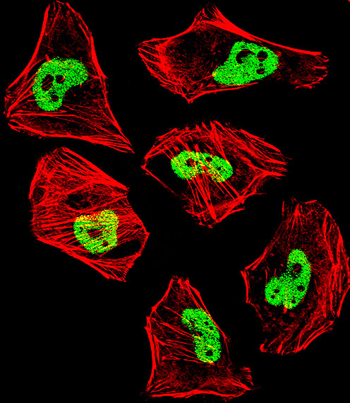 TDP-43 / TARDBP Antibody - Fluorescent confocal image of HeLa cell stained with TARDBP Antibody. HeLa cells were fixed with 4% PFA (20 min), permeabilized with Triton X-100 (0.1%, 10 min), then incubated with TARDBP primary antibody (1:25, 1 h at 37°C). For secondary antibody, Alexa Fluor 488 conjugated donkey anti-rabbit antibody (green) was used (1:400, 50 min at 37°C). Cytoplasmic actin was counterstained with Alexa Fluor 555 (red) conjugated Phalloidin (7units/ml, 1 h at 37°C). Nuclei were counterstained with DAPI (blue) (10 ug/ml, 10 min). TARDBP immunoreactivity is localized to nucleus significantly and Cytoplasm weakly.