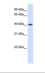 TDP-43 / TARDBP Antibody - Fetal muscle lysate. Antibody concentration: 1.0 ug/ml. Gel concentration: 12%.  This image was taken for the unconjugated form of this product. Other forms have not been tested.