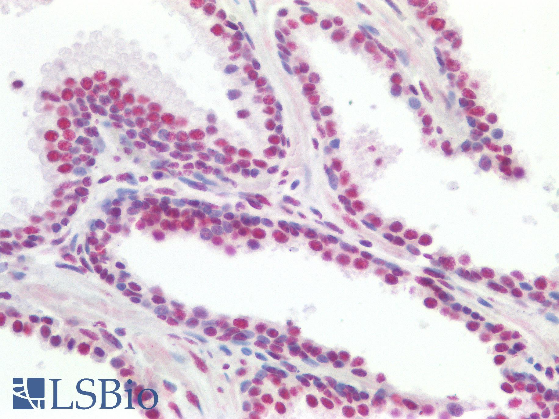 TDP-43 / TARDBP Antibody - Human Prostate: Formalin-Fixed, Paraffin-Embedded (FFPE)
