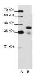 TDP-43 / TARDBP Antibody - A: Marker, B: Jurkat Cell Lysate.  This image was taken for the unconjugated form of this product. Other forms have not been tested.