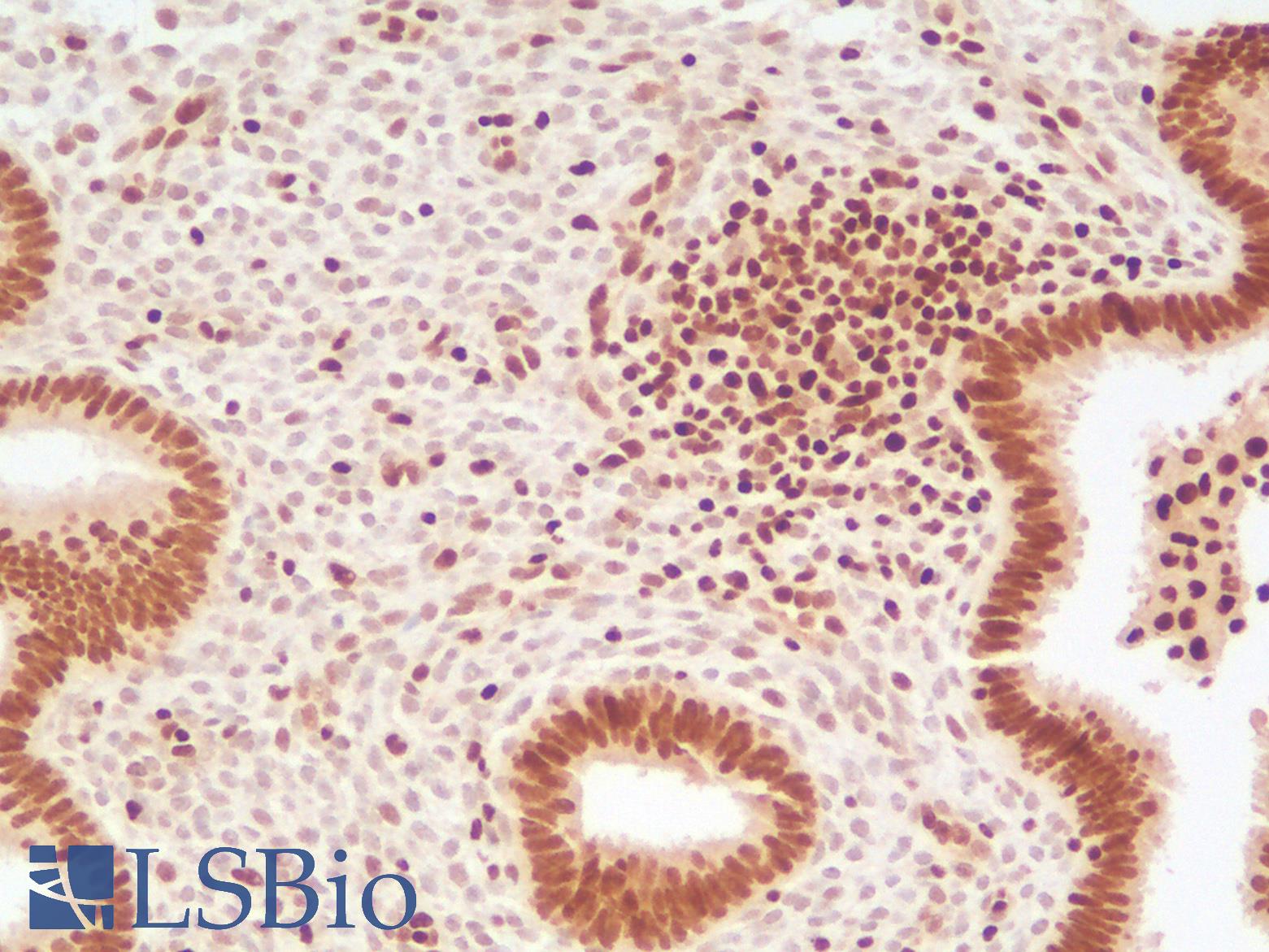 TFE3 Antibody - Human Uterus: Formalin-Fixed, Paraffin-Embedded (FFPE)