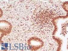 TFE3 Antibody - Human Uterus: Formalin-Fixed, Paraffin-Embedded (FFPE)