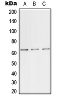 TFE3 Antibody - Western blot analysis of TFE3 expression in HeLa (A); mouse lung (B); PC12 (C) whole cell lysates.