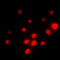 TFE3 Antibody - Immunofluorescent analysis of TFE3 staining in PC12 cells. Formalin-fixed cells were permeabilized with 0.1% Triton X-100 in TBS for 5-10 minutes and blocked with 3% BSA-PBS for 30 minutes at room temperature. Cells were probed with the primary antibody in 3% BSA-PBS and incubated overnight at 4 C in a humidified chamber. Cells were washed with PBST and incubated with a DyLight 594-conjugated secondary antibody (red) in PBS at room temperature in the dark. DAPI was used to stain the cell nuclei (blue).
