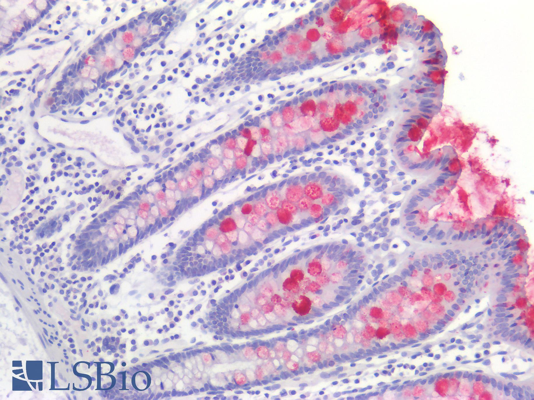 TFF1 / pS2 Antibody - Human Colon: Formalin-Fixed, Paraffin-Embedded (FFPE)