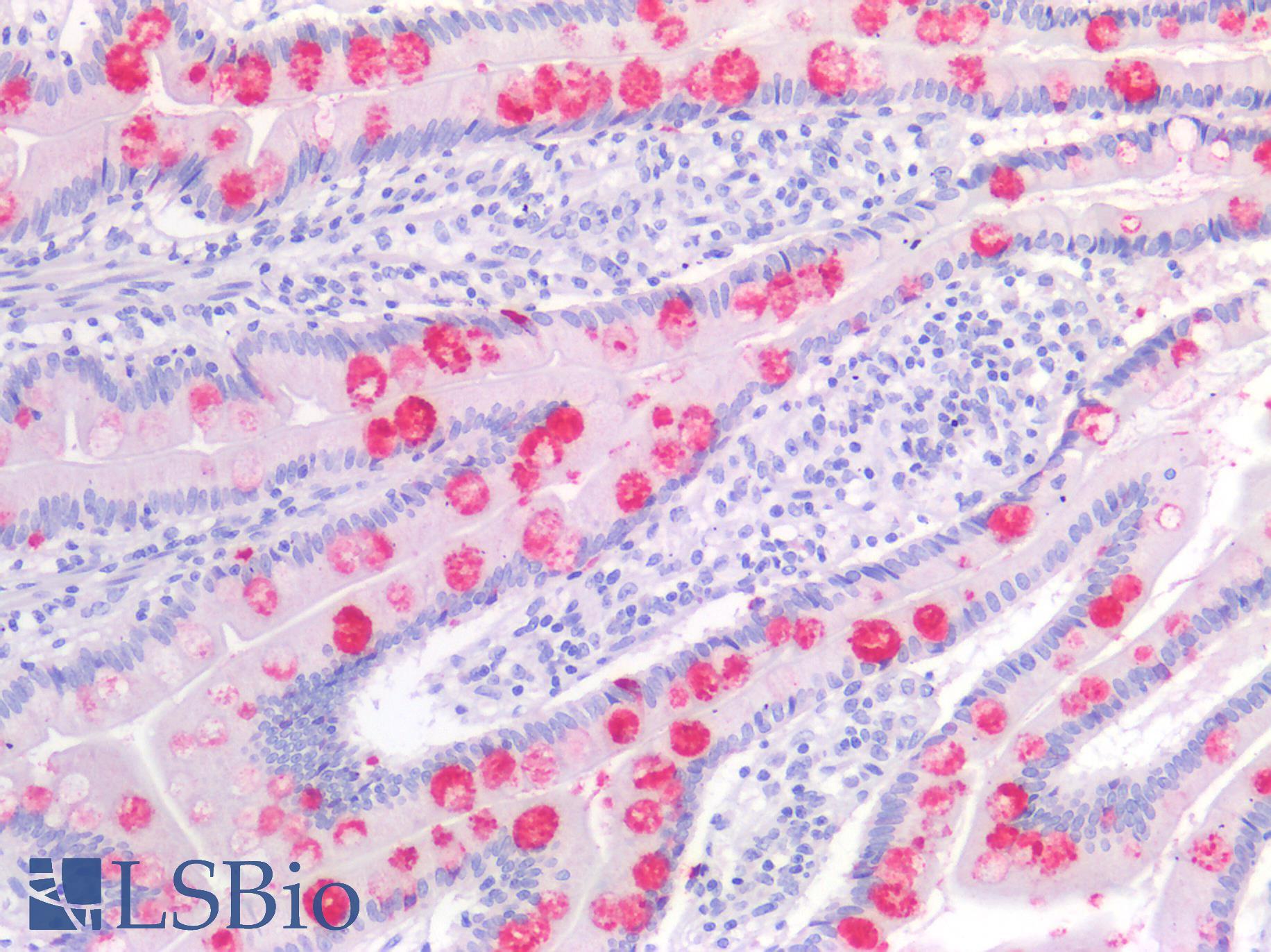TFF1 / pS2 Antibody - Human Small Intestine: Formalin-Fixed, Paraffin-Embedded (FFPE)
