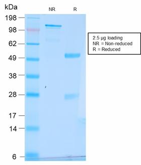 TFF1 / pS2 Antibody - SDS-PAGE Analysis Purified pS2 Rabbit Recombinant Monoclonal Antibody (TFF1/2969R). Confirmation of Purity and Integrity of Antibody.