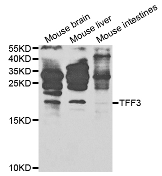 TFF3 / Trefoil Factor 3 Antibody - Western blot analysis of extracts of various cell lines, using TFF3 antibody.