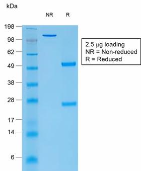 TG / Thyroglobulin Antibody - SDS-PAGE Analysis Purified Thyroglobulin Mouse Recombinant Monoclonal Antibody (rTGB24). Confirmation of Purity and Integrity of Antibody.