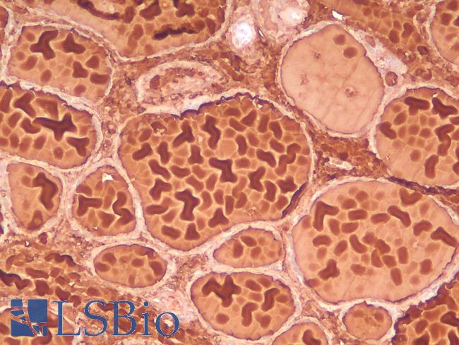 TG / Thyroglobulin Antibody - Human Thyroid: Formalin-Fixed, Paraffin-Embedded (FFPE)