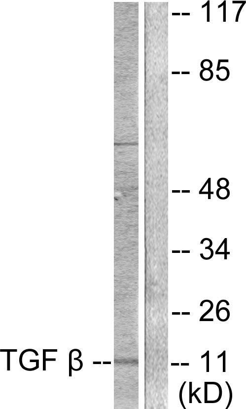 TGFB3 / TGF Beta3 Antibody - Western blot analysis of lysates from COS7 cells, using TGF beta3 Antibody. The lane on the right is blocked with the synthesized peptide.