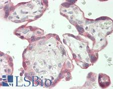 TGFBR2 Antibody - Human Placenta: Formalin-Fixed, Paraffin-Embedded (FFPE)
