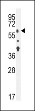TGFBR2 Antibody - TGFBR2 Antibody western blot of mouse lung tissue lysates (35 ug/lane). The TGFBR2 antibody detected the TGFBR2 protein (arrow).