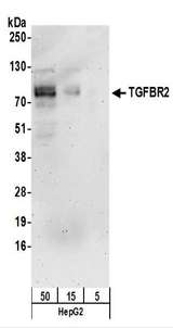 TGFBR2 Antibody - Detection of Human TGFBR2 by Western Blot. Samples: Whole cell lysate (5, 15 and 50 ug) prepared using NETN buffer from HepG2 cells. Antibodies: Affinity purified rabbit anti-TGFBR2 antibody used for WB at 1 ug/ml. Detection: Chemiluminescence with an exposure time of 3 minutes.